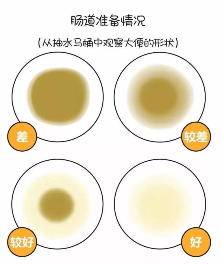 有效的肠道准备，肠镜结果截然不同！