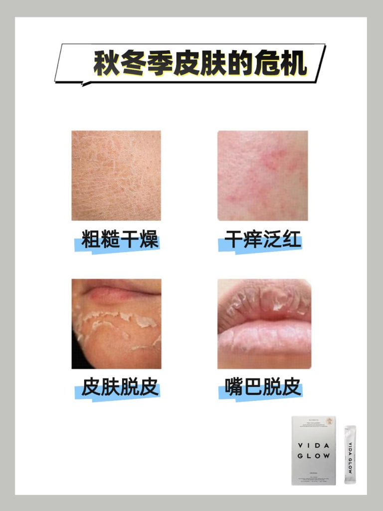 今日科普：秋冬危“肌”来袭！赶紧补胶原