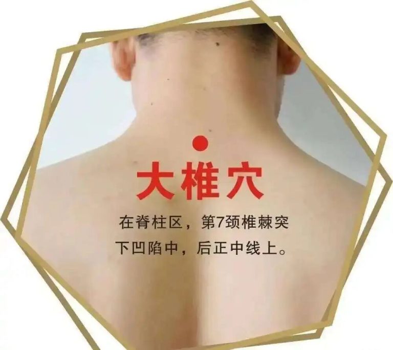 颈椎病的8个表现