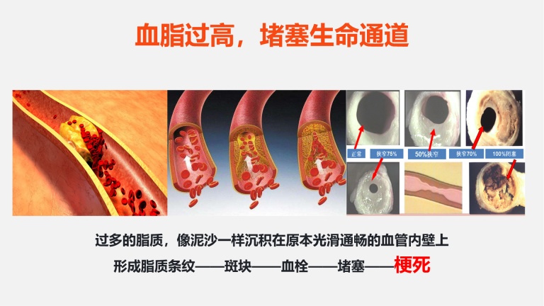 秋冬血管养护方案
